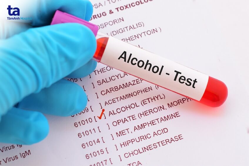 xét nghiệm chẩn đoán ngộ độc rượu