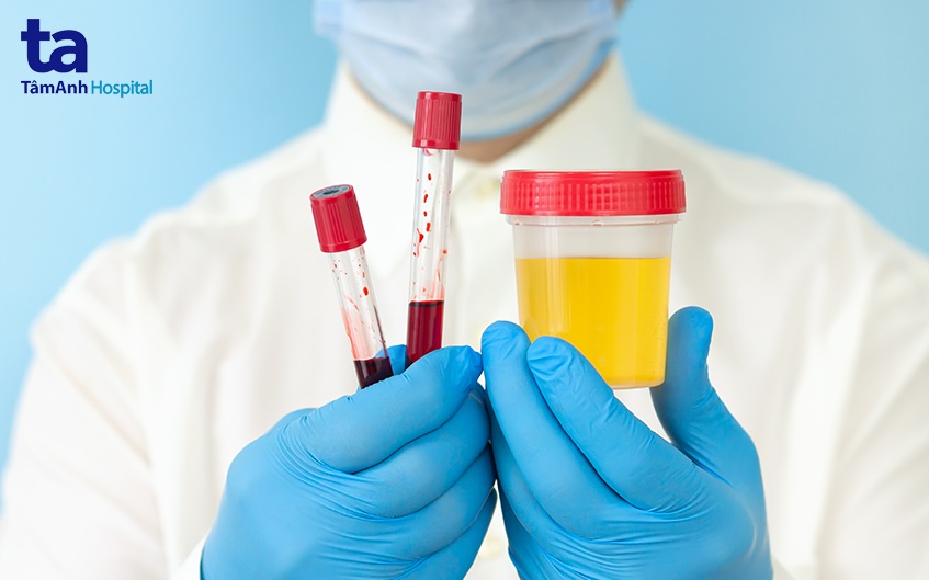 xét nghiệm máu và nước tiểu