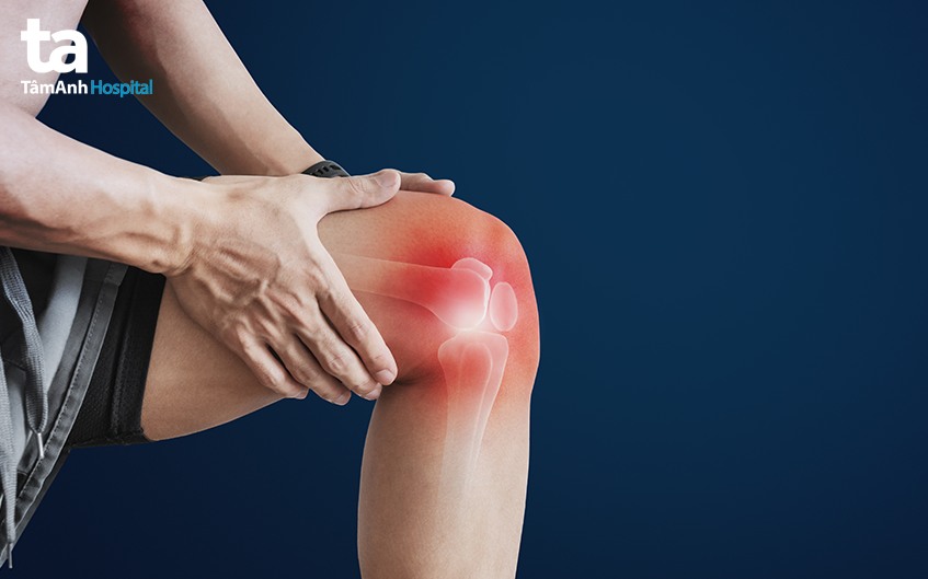 ai cần chụp x-quang khớp gối