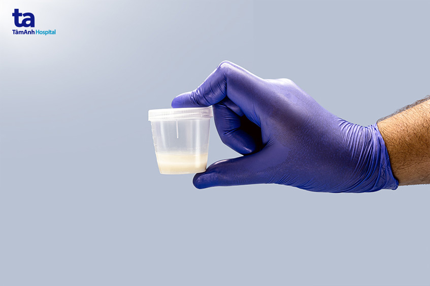 chẩn đoán phân mảnh dna tinh trùng