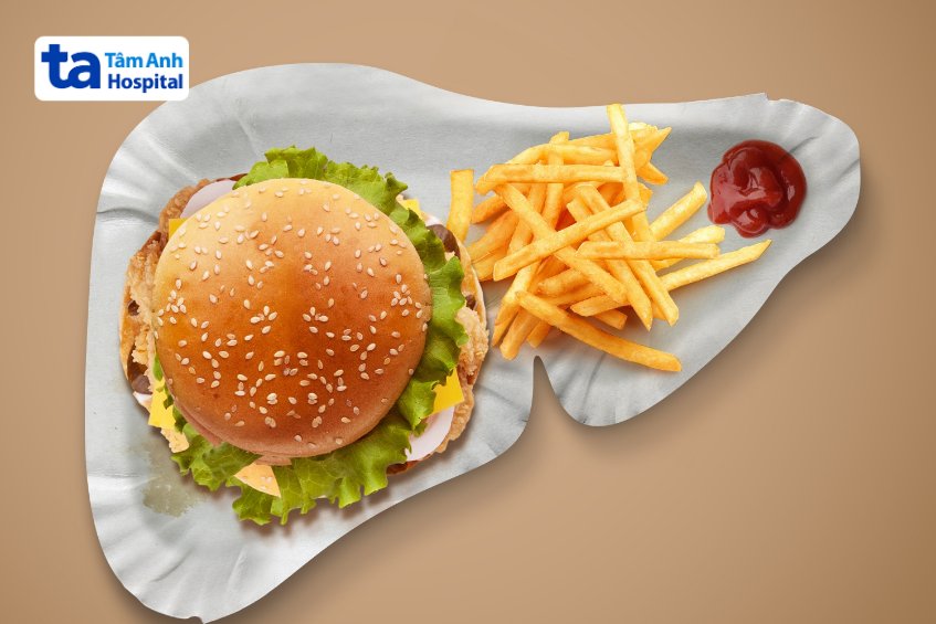 chế độ của gan nhiễm mỡ độ 2