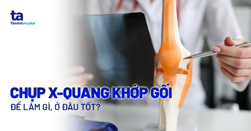 chụp x quang khớp gối ở đâu