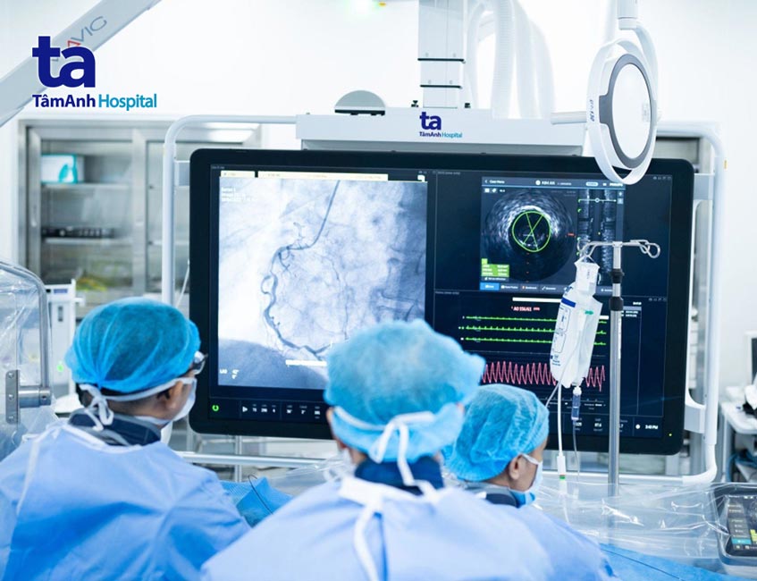 đặt stent nong mạch vành