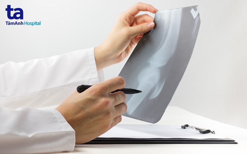 đọc x quang khớp gối