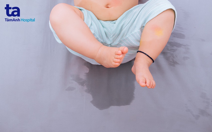 hiểu thêm về tiểu không tự chủ ở trẻ em