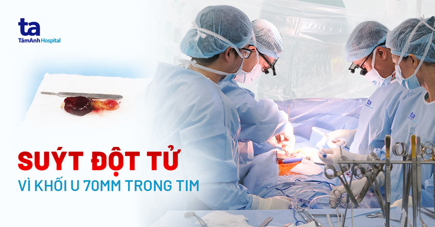 Đột ngột ngất xỉu, khám phát hiện khối u hiếm gặp trong tim