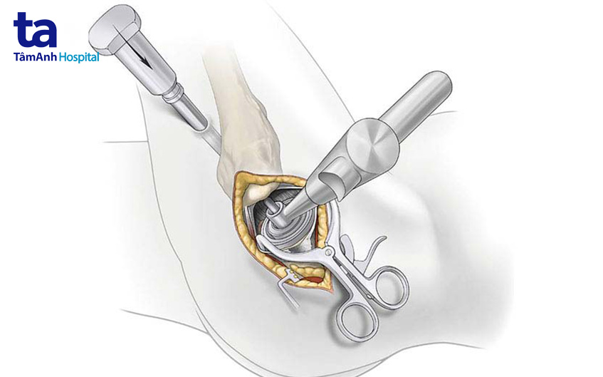 không gây đau đớn