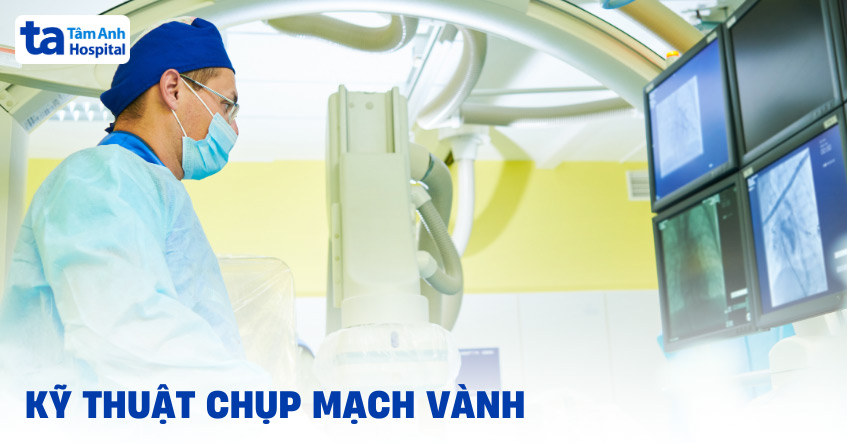 Chụp mạch vành có nguy hiểm không? Chỉ định và quy trình thực hiện
