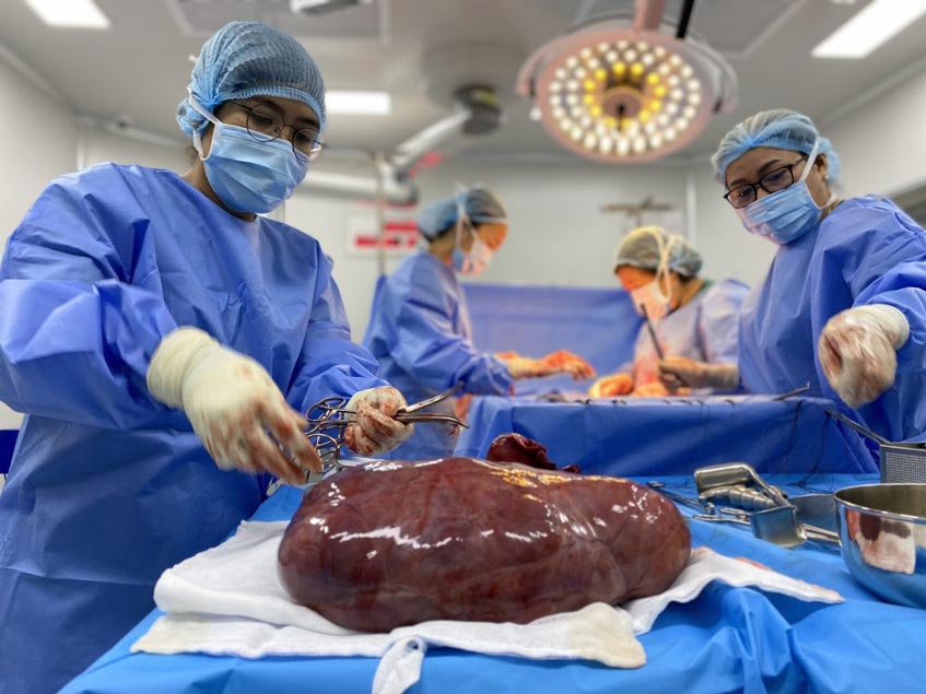 lấy khối u ra khỏi người bệnh