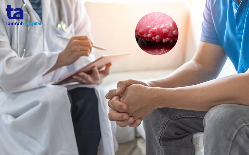 nên làm gì khi phát hiện chuỗi hạt ngọc dương vật