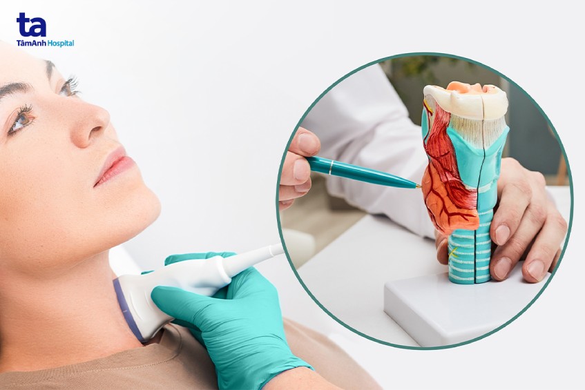 Phụ nữ có nguy cơ bị bướu giáp nhân thùy phải cao hơn nam giới.