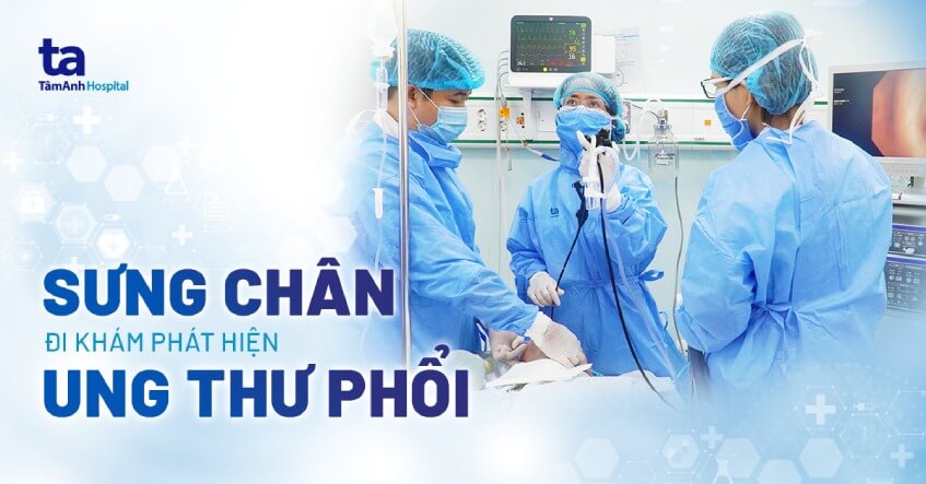 sưng chân đi khám phát hiện ung thư phổi