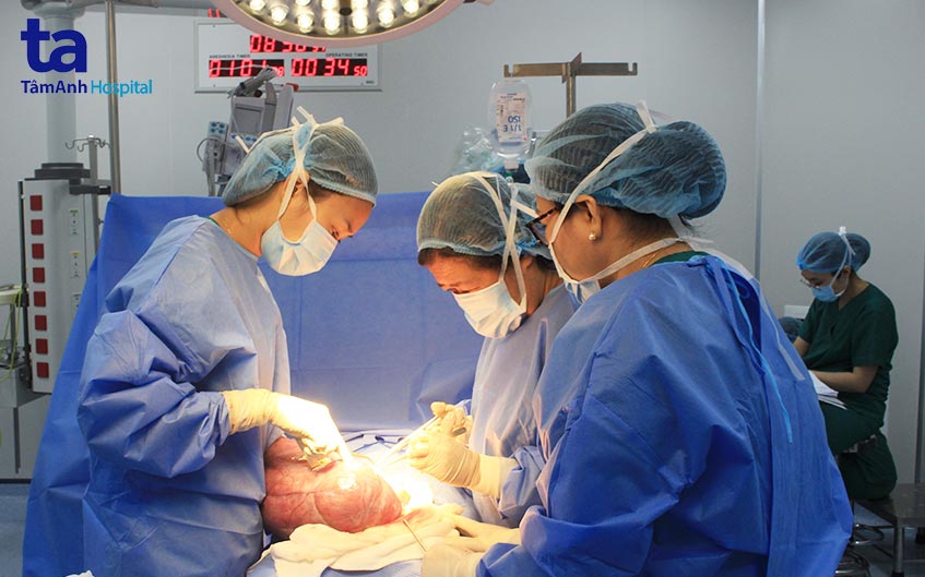 tiến hành bóc tách khối u xơ khổng lồ