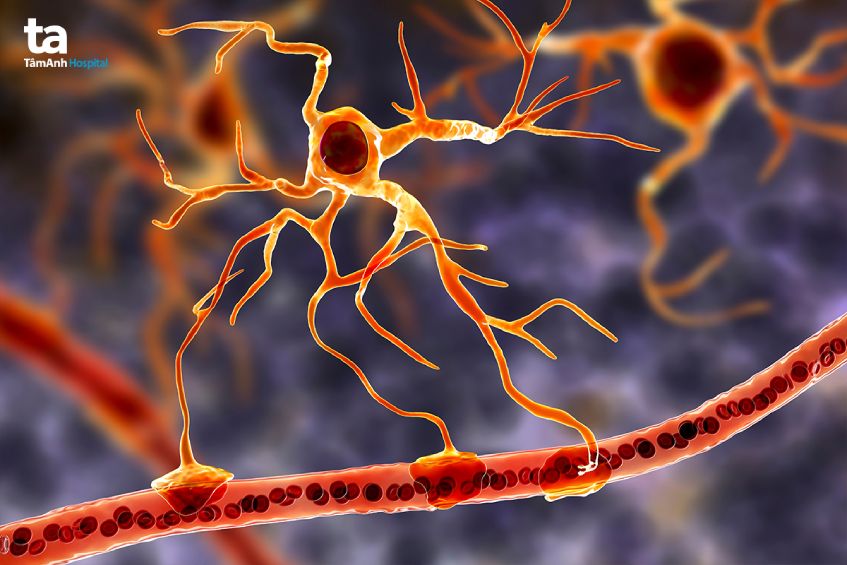 triệu chứng bệnh teo cơ do đái tháo đường