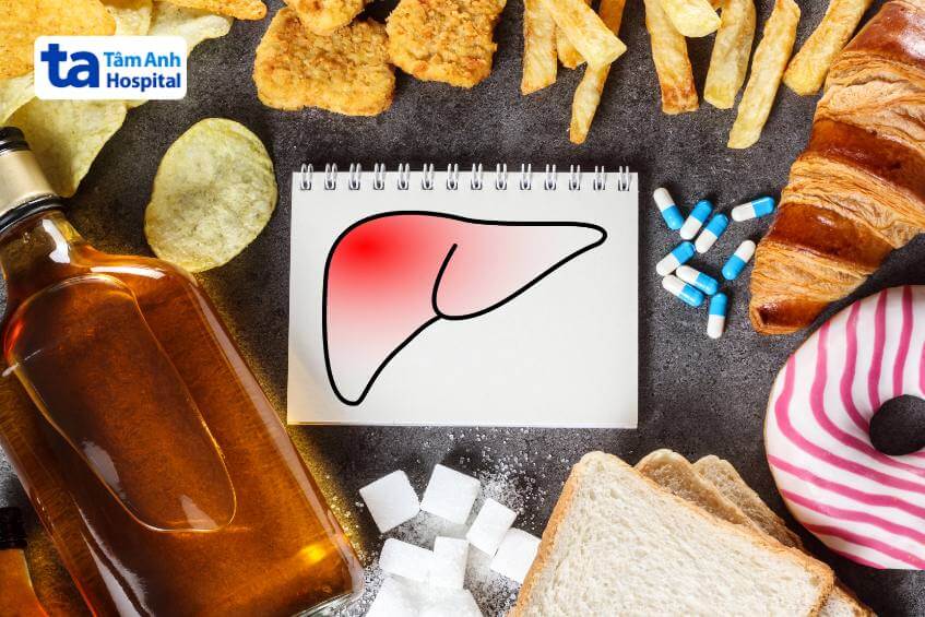 triệu chứng gan nhiễm mỡ độ 2