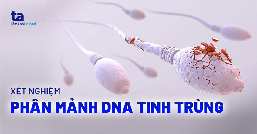 Xét nghiệm phân mảnh DNA tinh trùng trong chẩn đoán vô sinh hiếm muộn