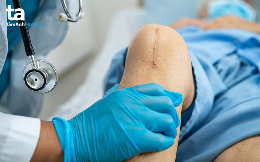 điều trị thông qua phẫu thuật