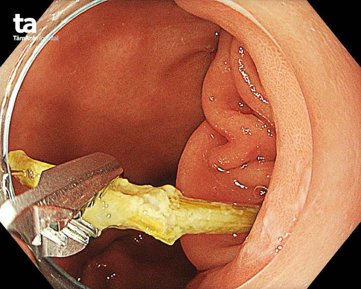 tăm tre đâm tá tràng