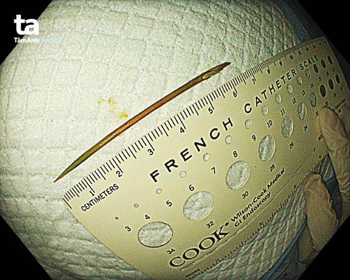 Hình ảnh cây tăm tre