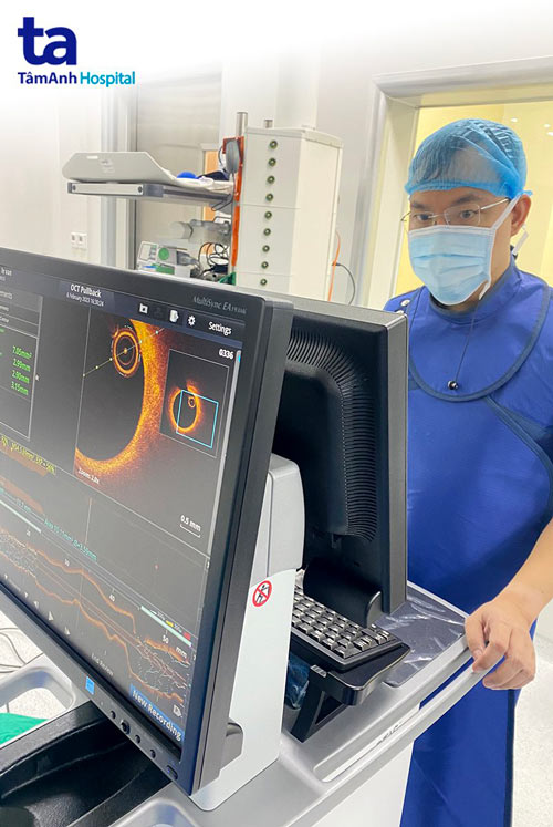 bác sĩ triển khai kỹ thuật oct