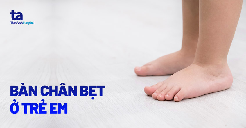 Bàn chân bẹt ở trẻ em: Nguyên nhân, triệu chứng, chẩn đoán