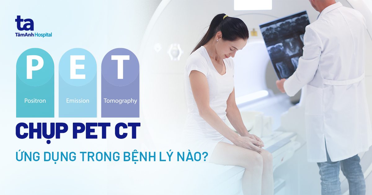 Chụp PET CT: Quy trình, khi nào thực hiện, ứng dụng trong bệnh lý nào?