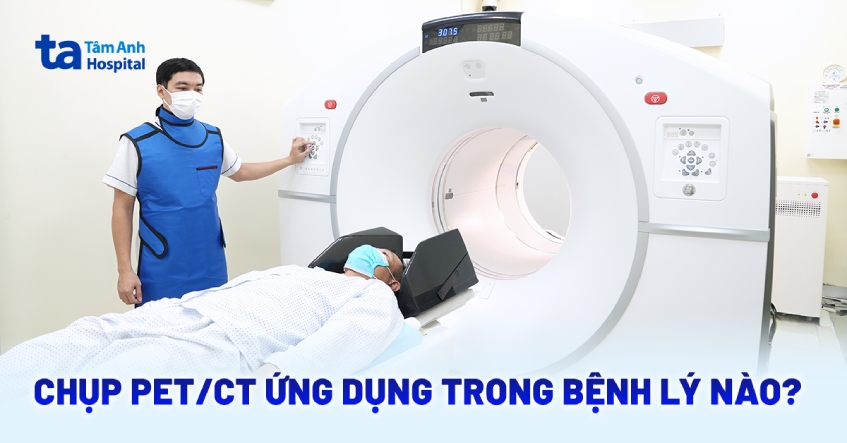 Chụp PET CT: Quy trình, khi nào thực hiện, ứng dụng trong bệnh lý nào?
