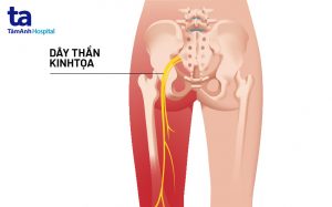trị liệu thần kinh cột sống
