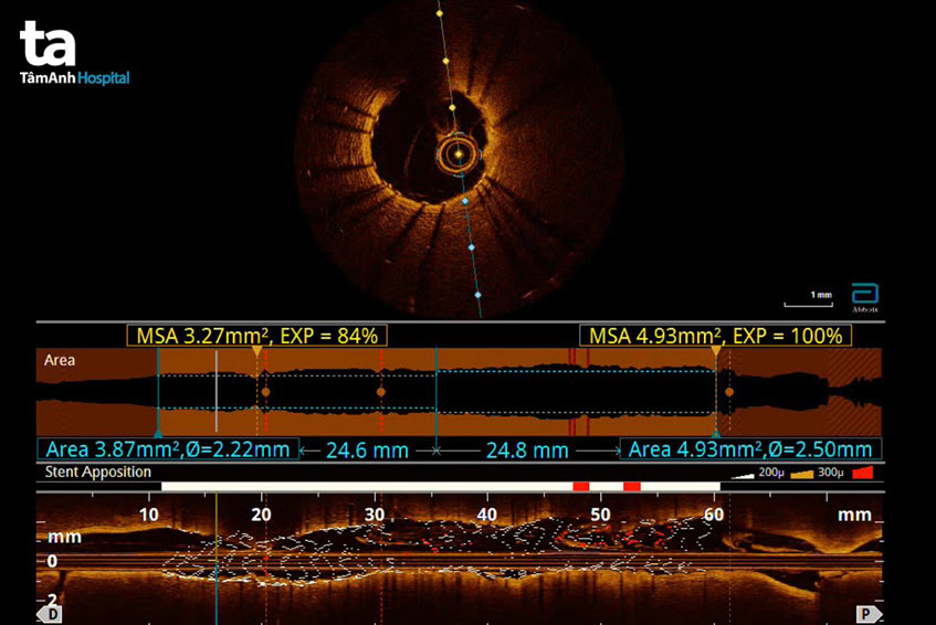 màn hình hiển thị