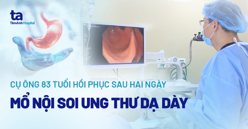 mỗ nội soi dạ dày