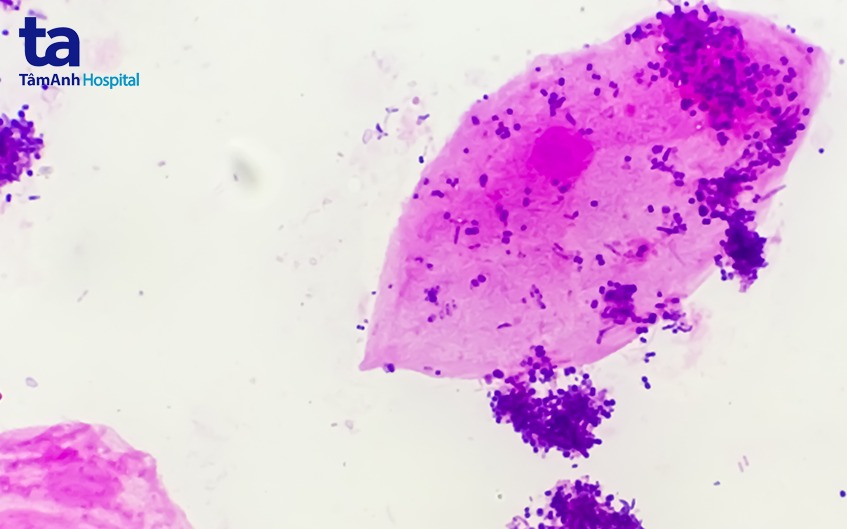 nguyên nhân gây bệnh lậu