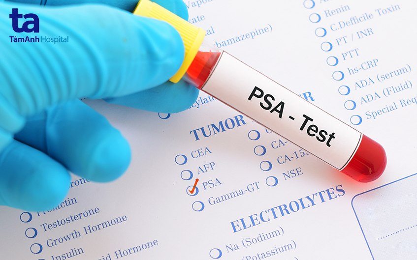 psa test