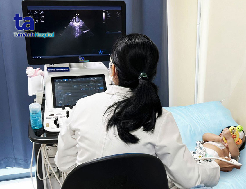 siêu âm tim cho bệnh nhi