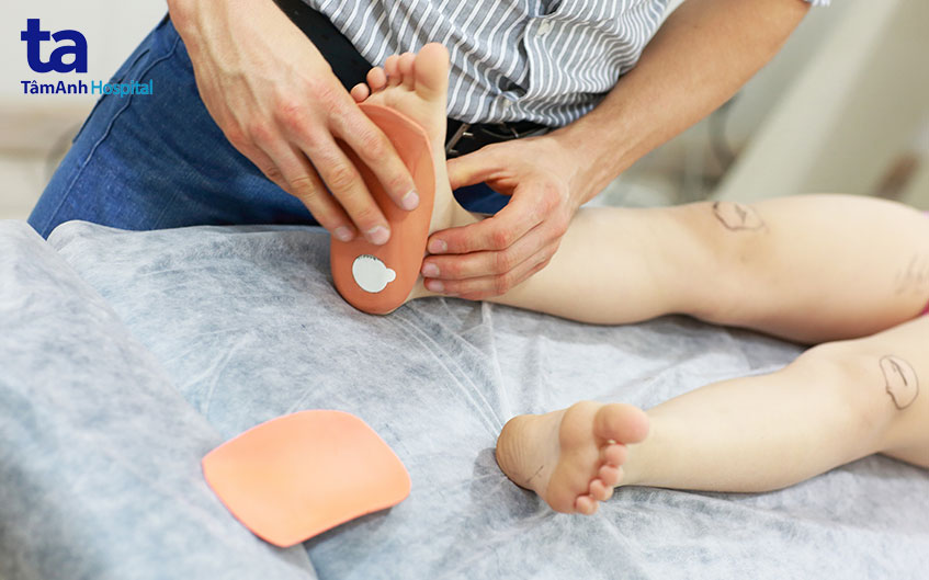 sử dụng đế chỉnh hình bàn chân