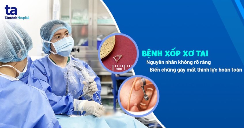 Bệnh xốp xơ tai: Nguyên nhân, dấu hiệu, điều trị và phòng ngừa