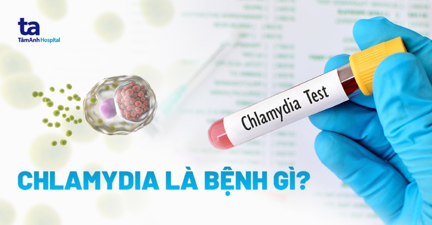 Bệnh Chlamydia: Nguyên nhân, triệu chứng, điều trị, phòng ngừa