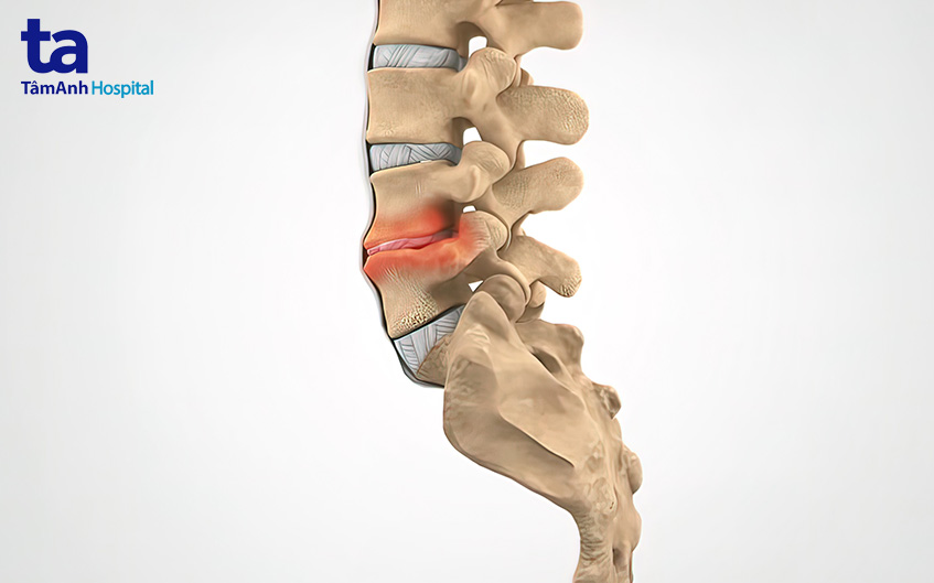 chỉ định phẫu thuật khẩn cấp