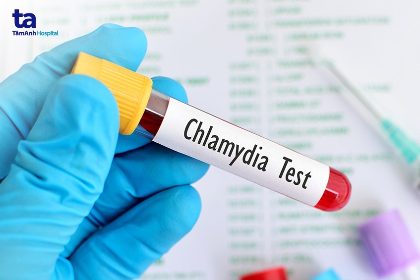 Chlamydia test