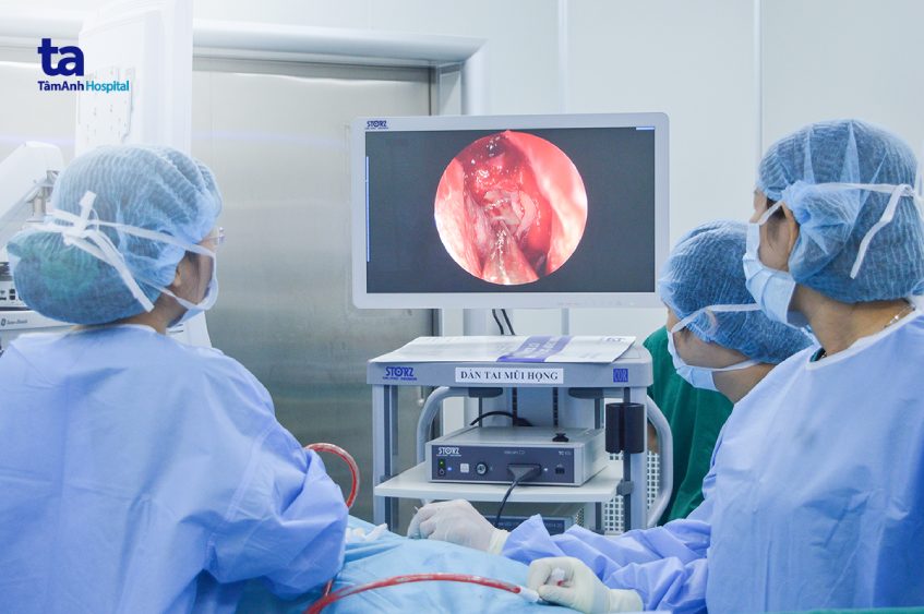phẫu thuật viêm xoang mạn