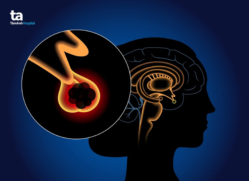 vị trí tuyến tùng