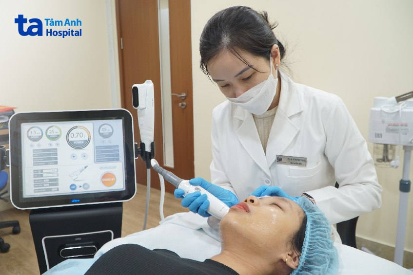 bác sĩ xóa nếp nhăn bằng công nghệ hifu