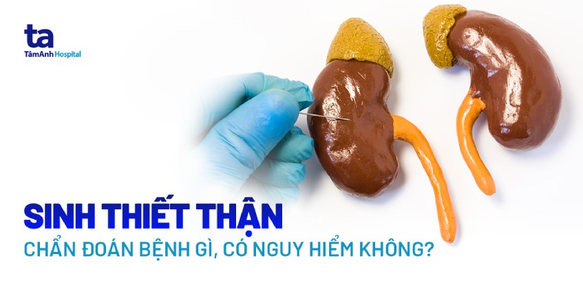 chọc sinh thiết thận