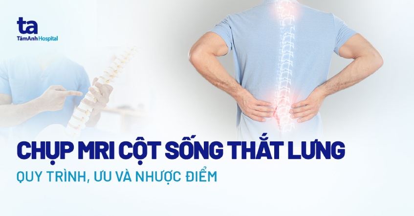 chụp mri cột sống thắt lưng