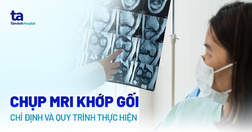 chụp mri khớp gối