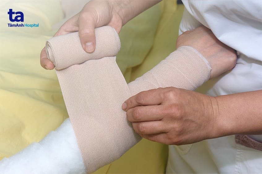 Điều trị bệnh phù bạch huyết