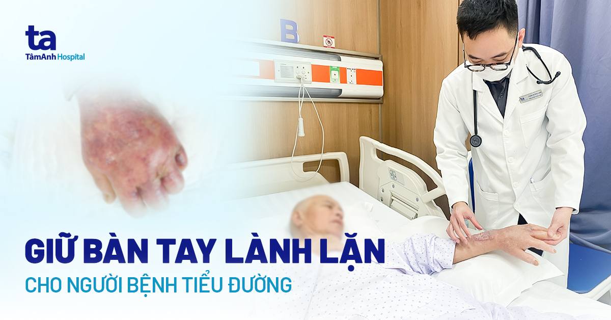 Giữ bàn tay lành lặn cho bệnh nhân tiểu đường
