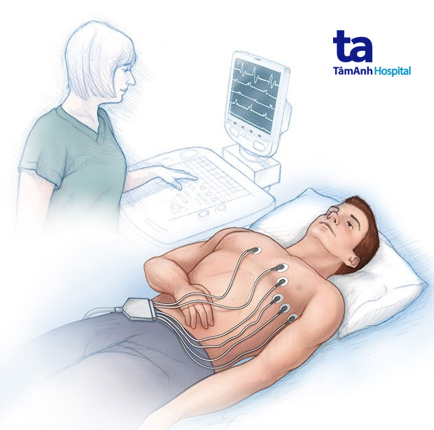 hình đo ecg