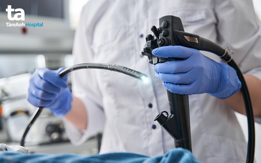 khi nào cần nội soi thực quản 