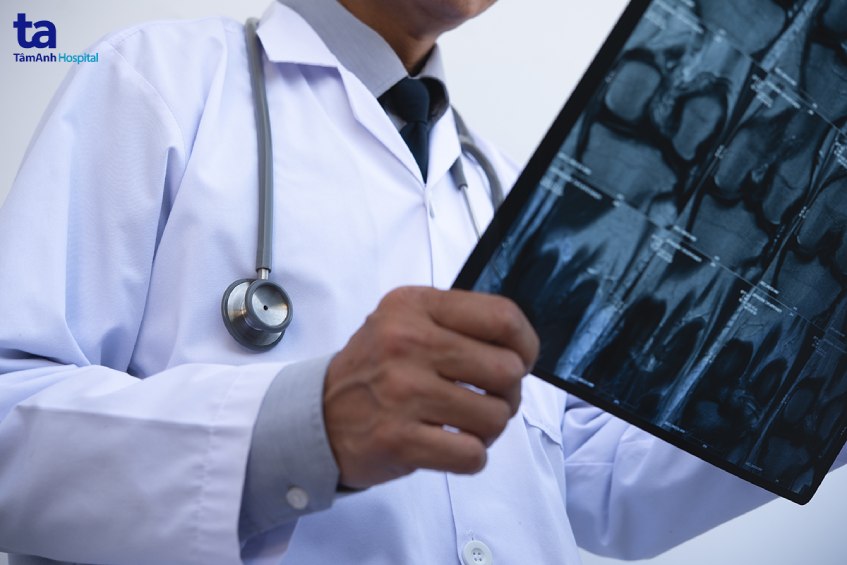 kỹ thuật chụp mri khớp gối