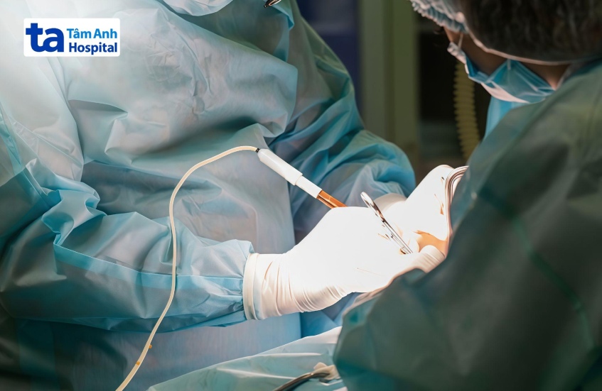 kỹ thuật sinh thiết phổi mở